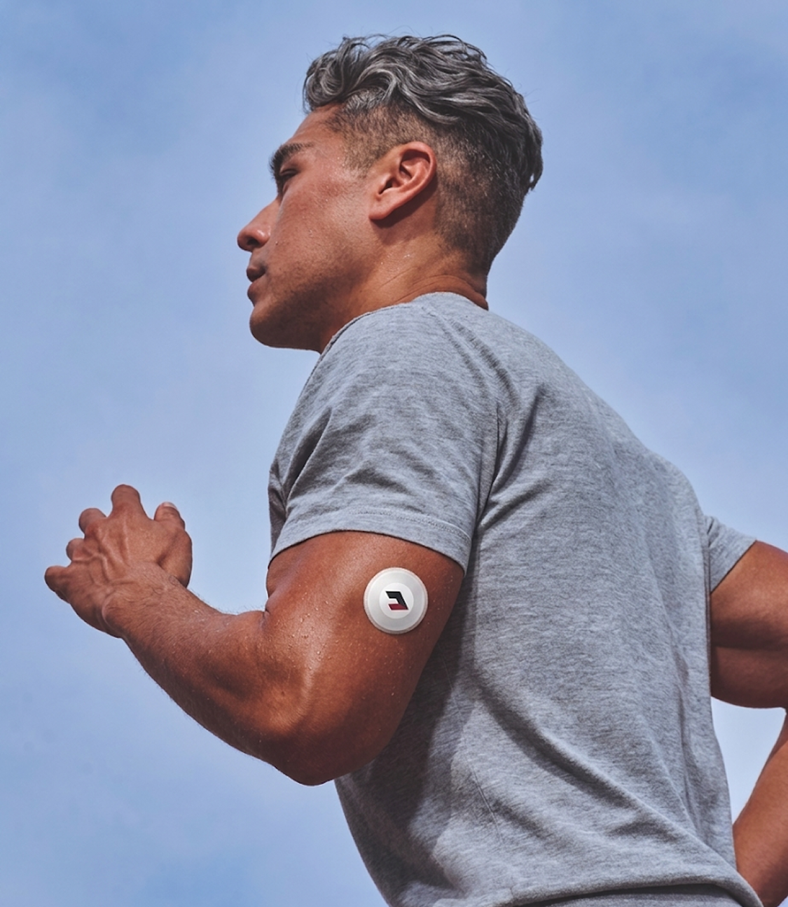 CGM sensor worn on an upper arm